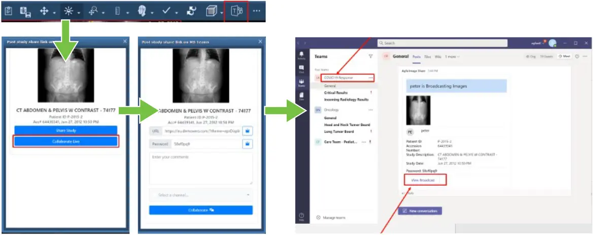 Microsoft Teams Enterprise Workflows